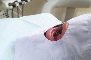 健康な噛み合わせを獲得するための歯科