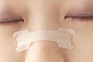 サージェリーアーリー対策完全ガイド2025：早期手術を避けるための効果的な方法