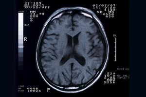 浜松市の信頼されている矯正歯科医院