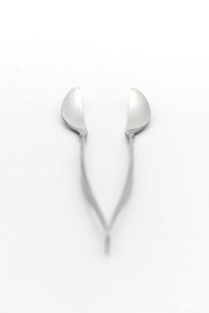 姫路市の精度の高いインプラント治療