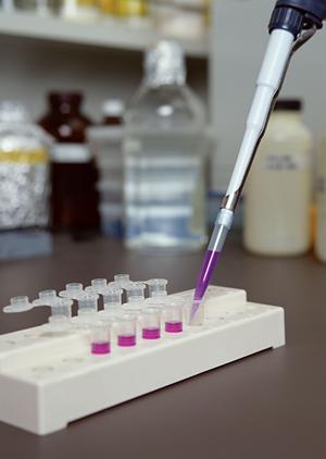 レセプトコンピュータの機能とは